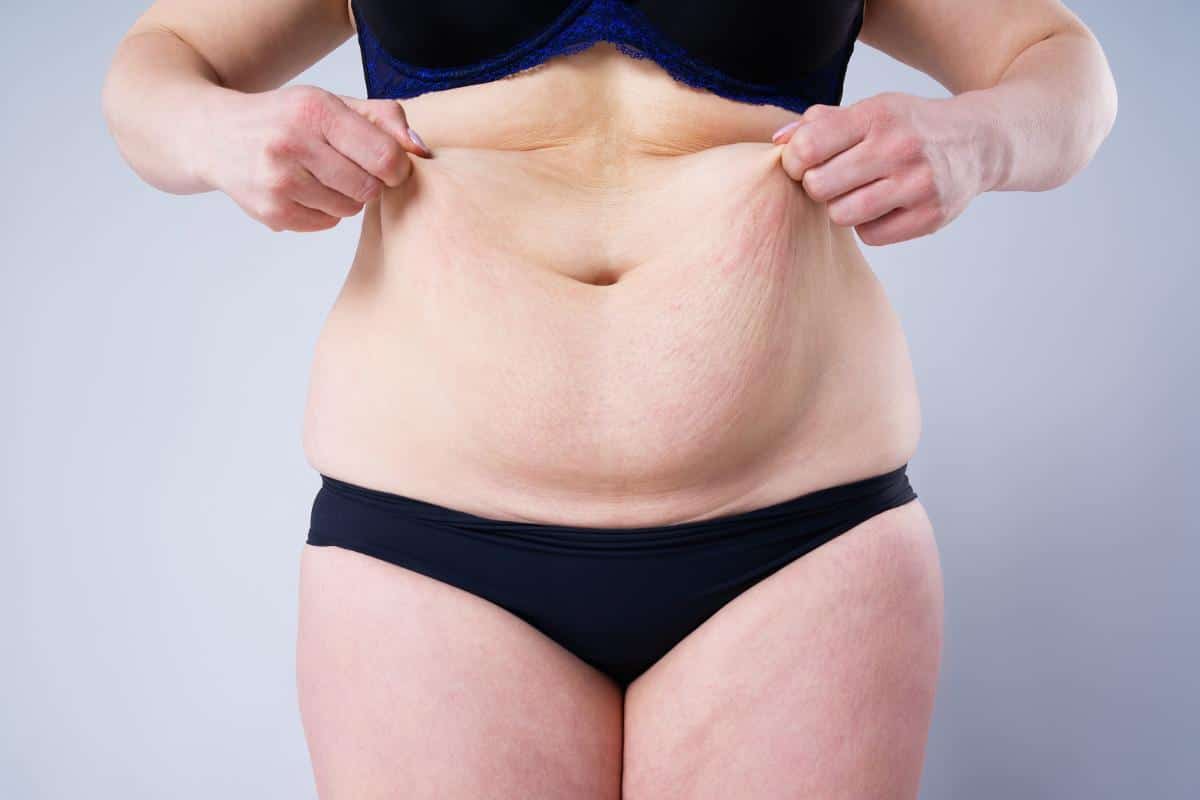 Against a neutral background, a person in underwear pinches the loose skin on their abdomen, reflecting the changes from weight loss.