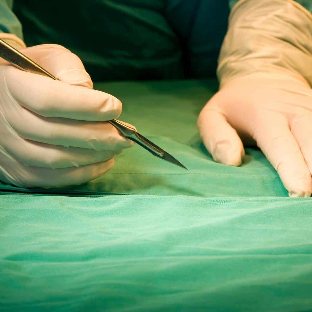 surgeon doing surgery with a scalpel